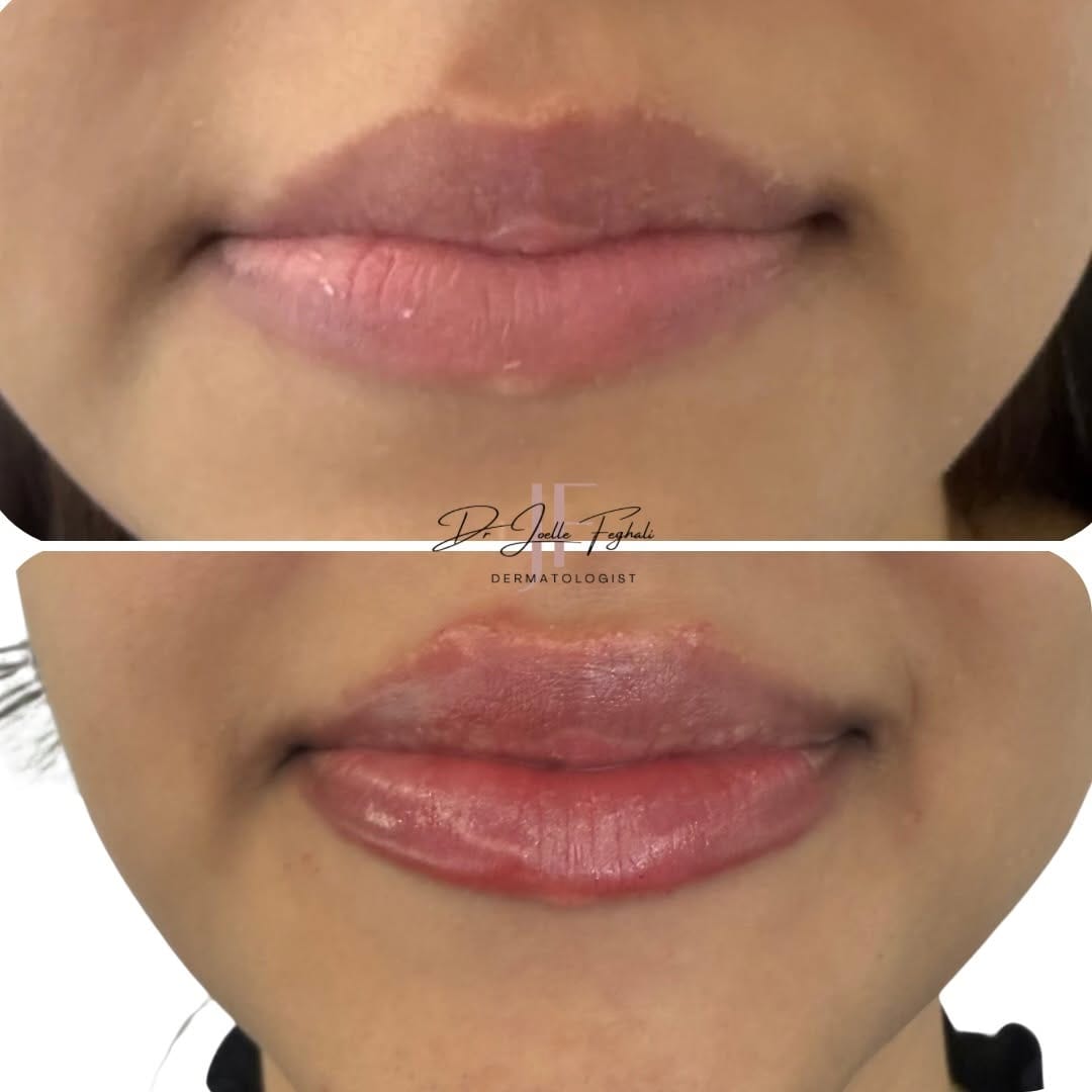 Post 8 by Dr. Joelle Feghali | Dermatologist on Instagram (image)