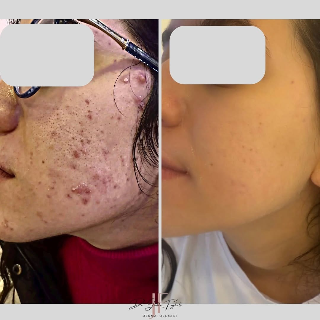 Post 9 by Dr. Joelle Feghali | Dermatologist on Instagram (image)