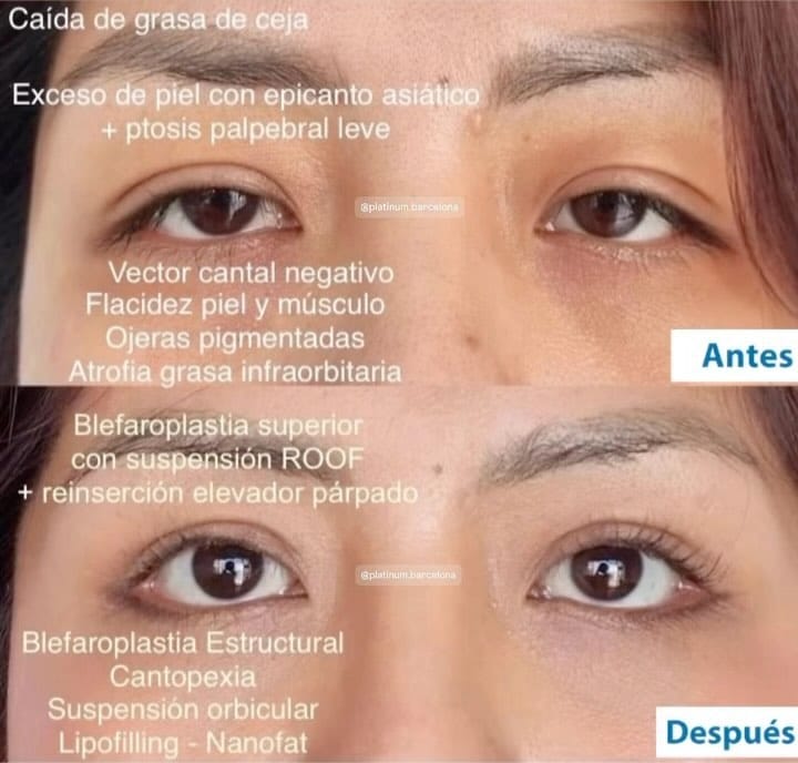 Post 10 by Dr. Angel Pecorelli, MD, IBCS on Instagram (carousel)