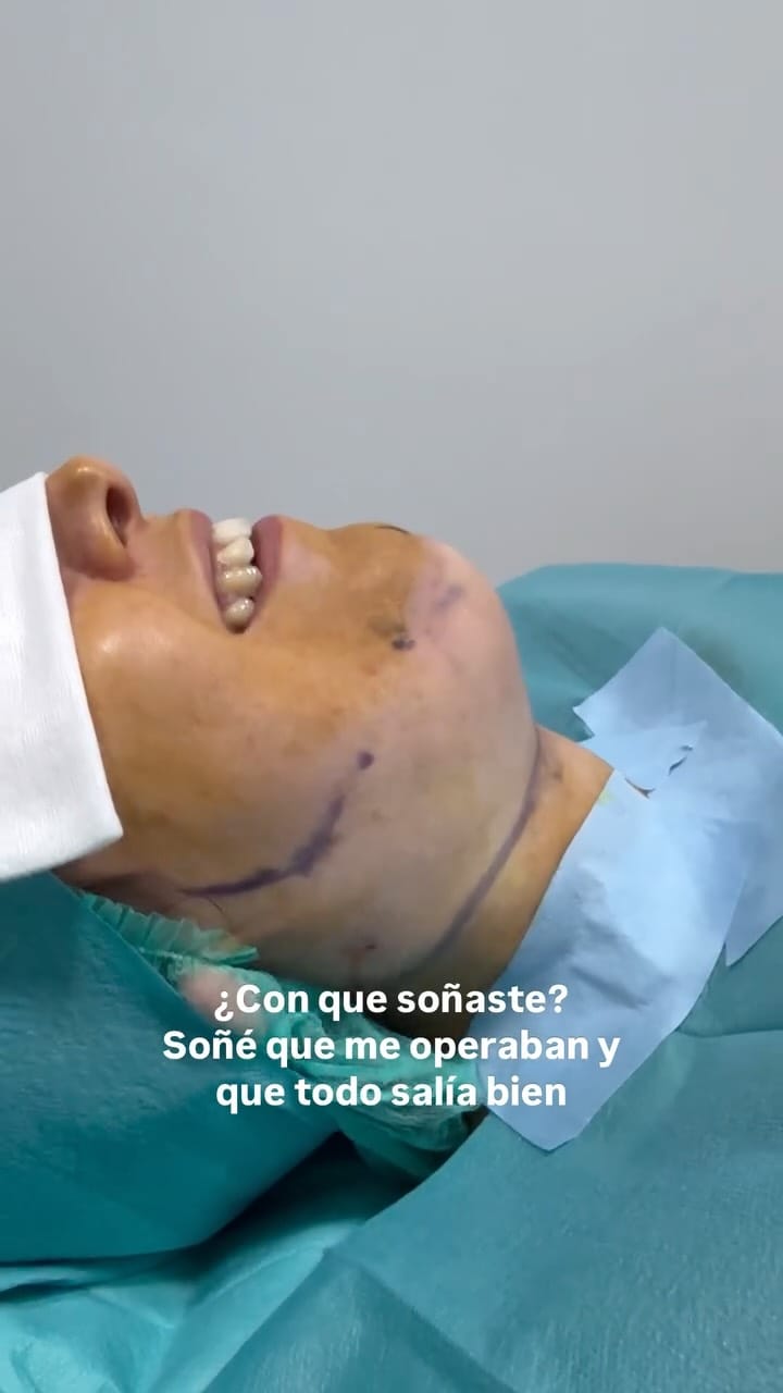 Post 6 by Dr. Angel Pecorelli, MD, IBCS on Instagram (video)