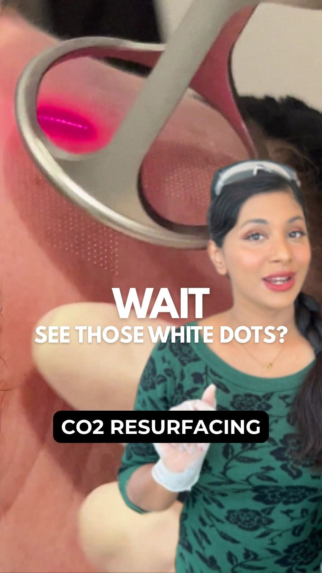 Post 9 by LLC Cosmetic Laser Clinics on Instagram (video)