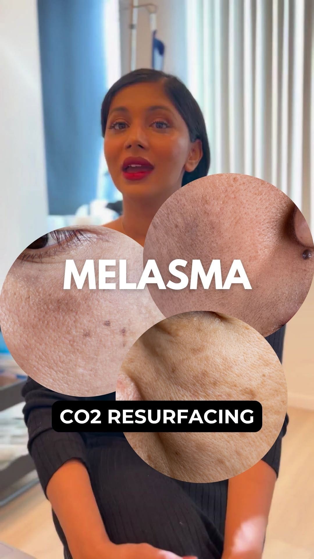 Post 5 by LLC Cosmetic Laser Clinics on Instagram (video)