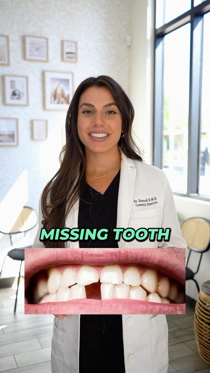 Post 6 by Revan Dawood | Gilbert Dentist on Instagram (video)