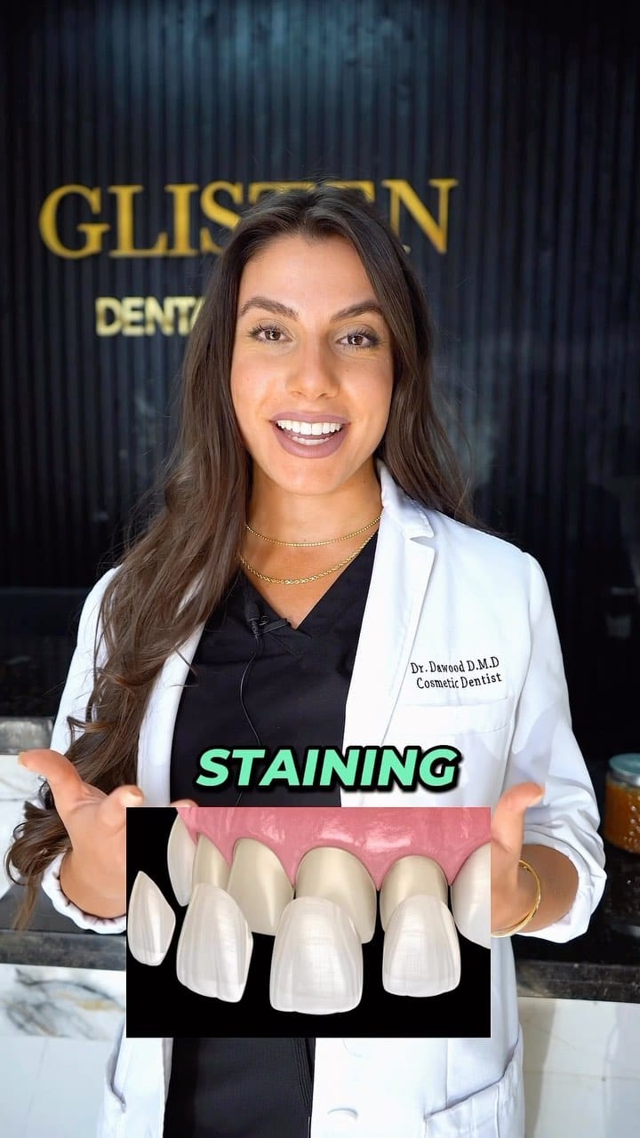 Post 9 by Revan Dawood | Gilbert Dentist on Instagram (video)