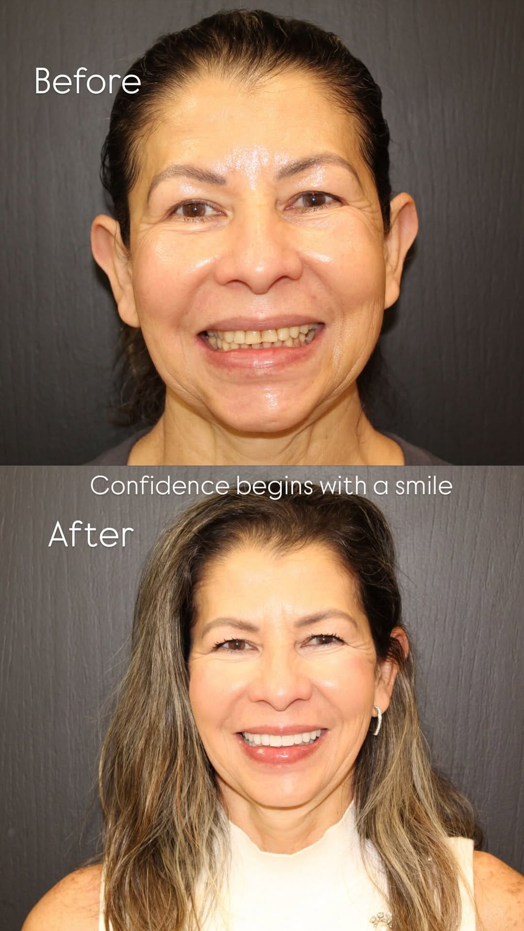 Post 8 by Dr. Erika Mendez on Instagram (video)
