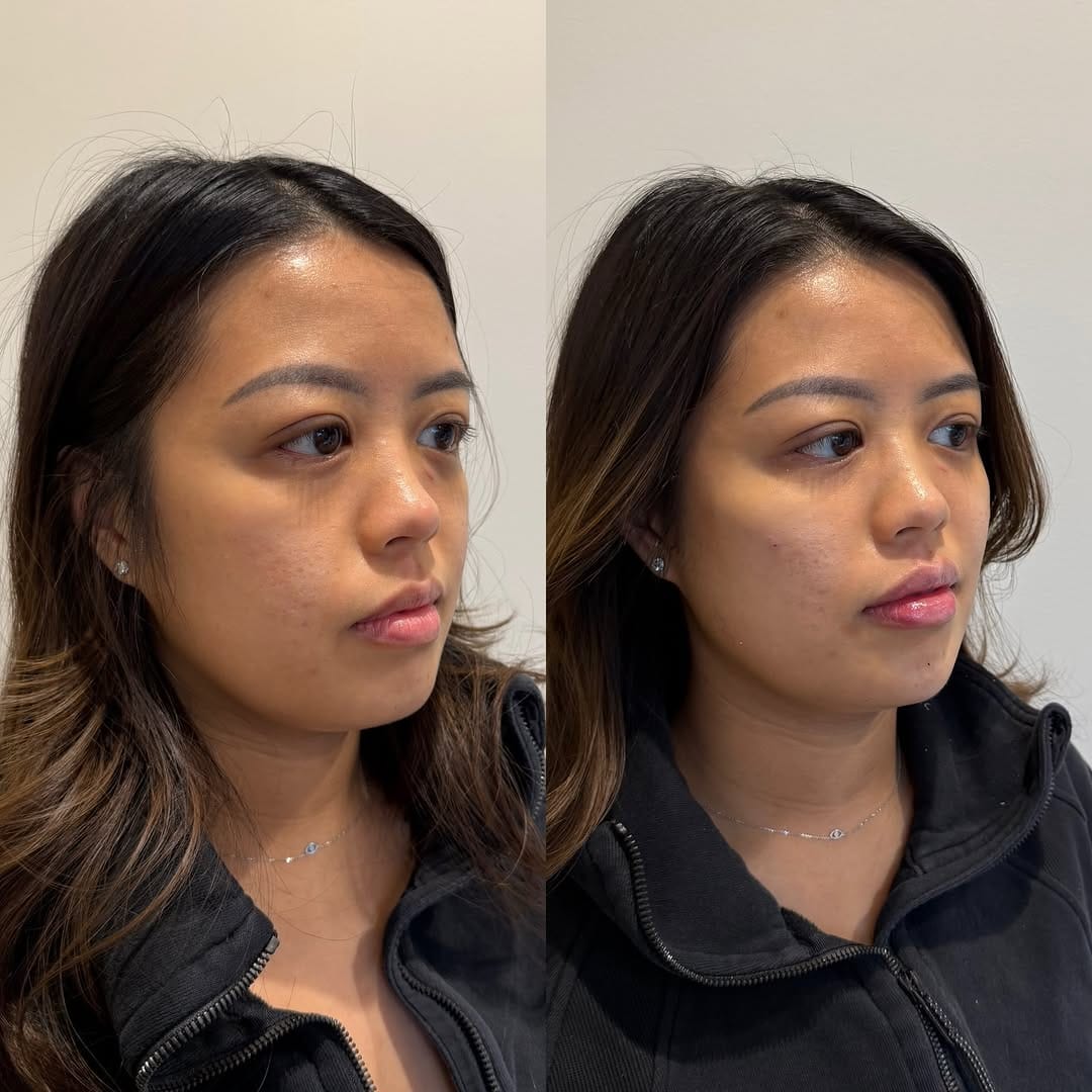 Post 5 by Lauren Zaucha, MMS, PA-C on Instagram (carousel)
