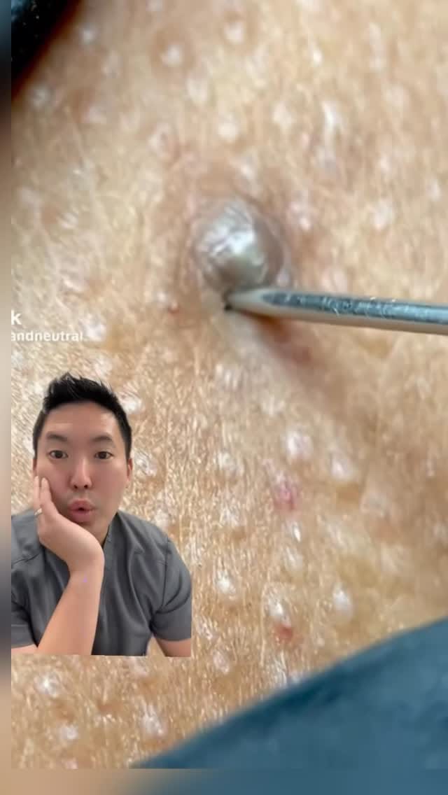 Post 1 by Dr. Daniel Sugai, MD, FAAD on Instagram (video)