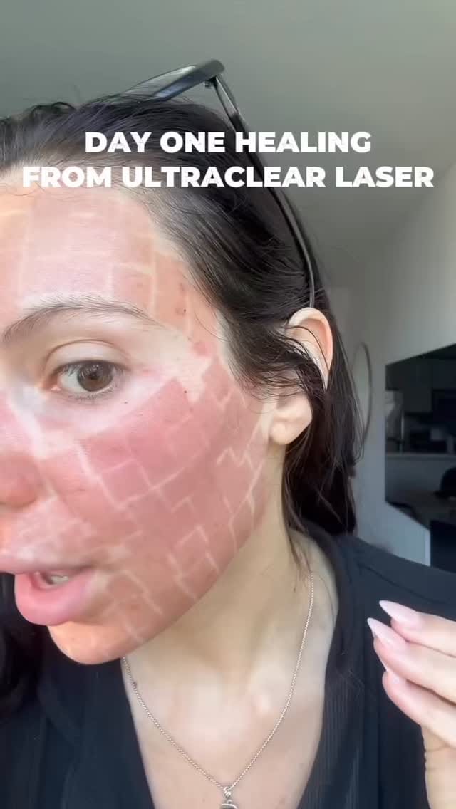 Post 4 by La Réserve Aesthetics and Wellness on Instagram (video)