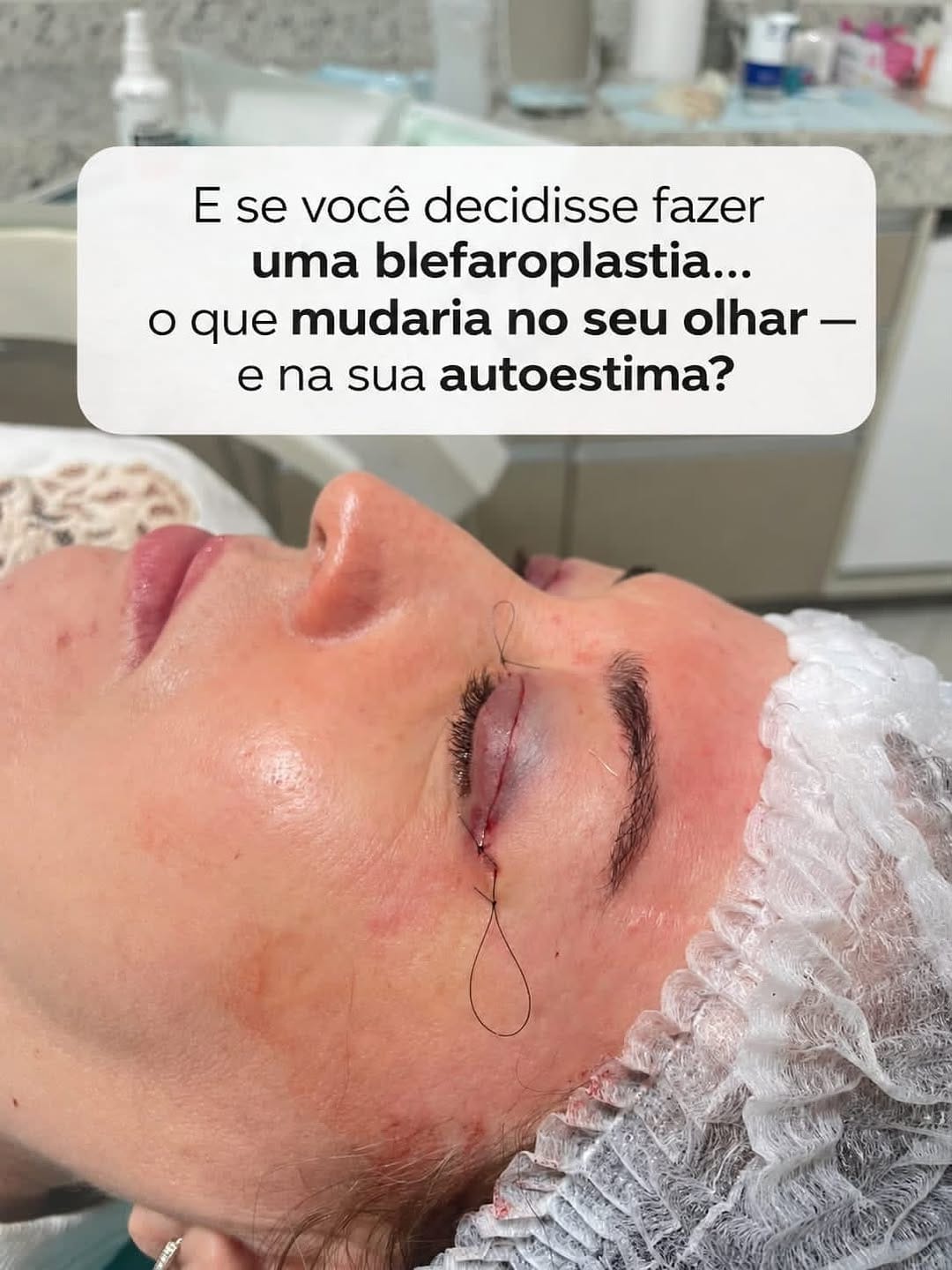 Post 3 by Dra Gabriela Melo - Harmonização facial on Instagram (carousel)