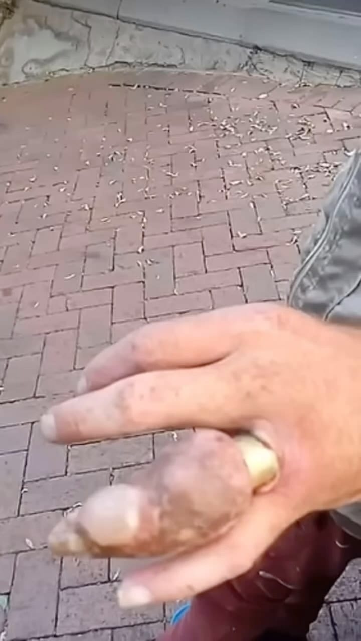 Post 2 by 🔞 CIRUGÍAS/CIRUJANOS/SURGERY on Instagram (video)