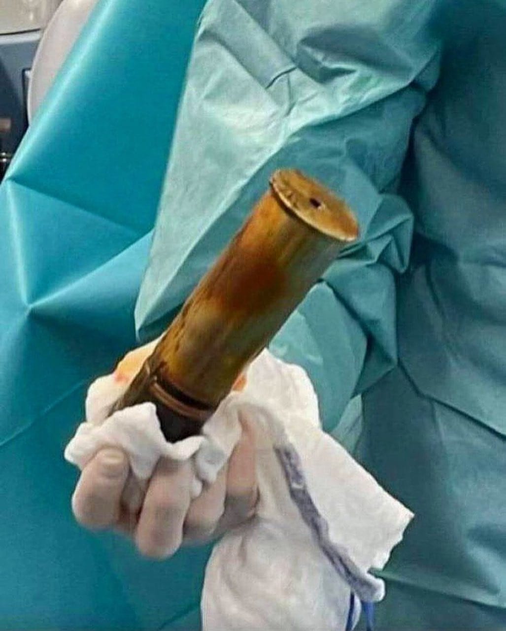 Post 10 by 🔞 CIRUGÍAS/CIRUJANOS/SURGERY on Instagram (image)