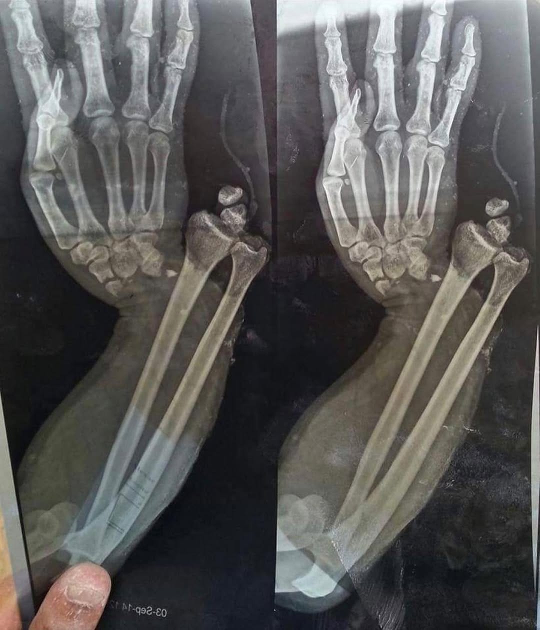 Post 8 by 🔞 CIRUGÍAS/CIRUJANOS/SURGERY on Instagram (image)