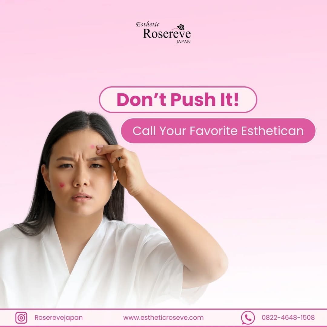 Post 6 by Esthetic Rosereve Official® on Instagram (image)