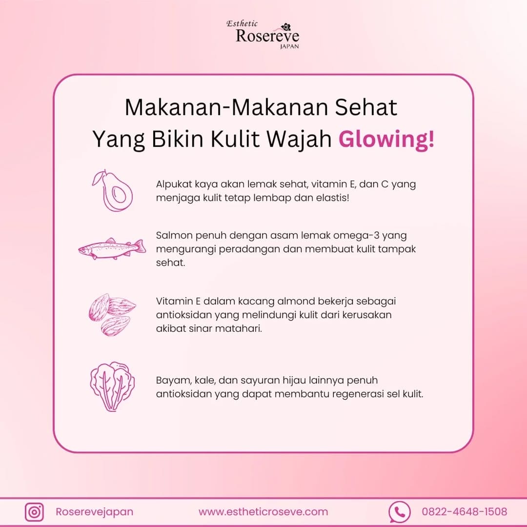 Post 8 by Esthetic Rosereve Official® on Instagram (image)