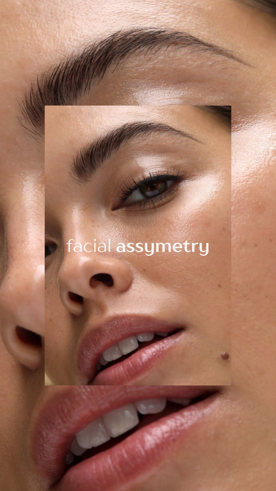 Post 2 by Perth Cosmetic Clinic on Instagram (video)