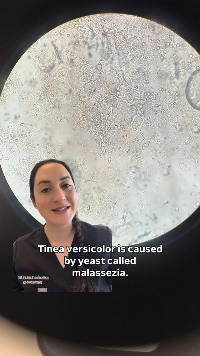 Post 6 by Dr. Katharine Saussy | Dermatologist on Instagram (video)