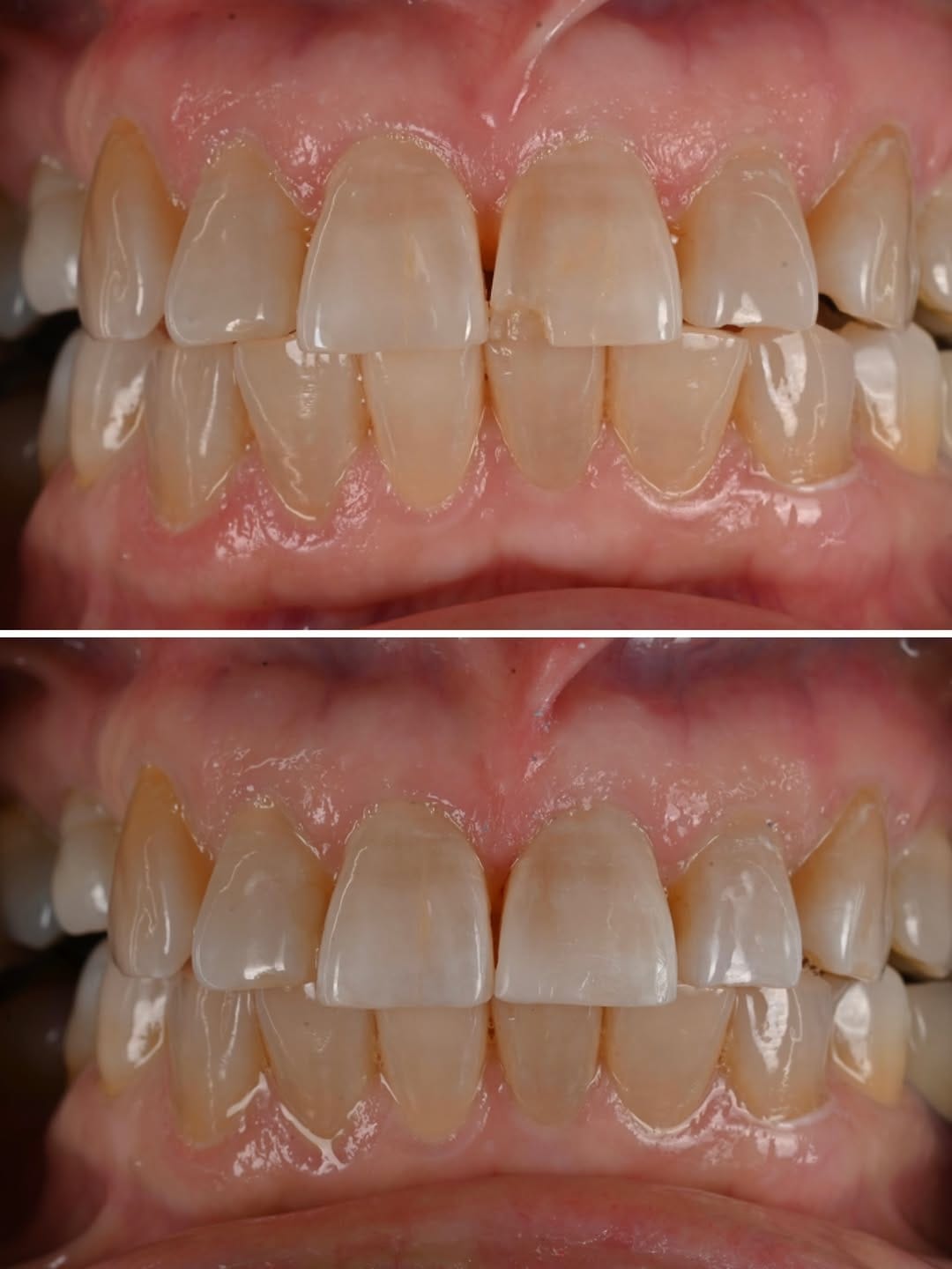 Post 3 by Dr. Domenica Paredes, DMD on Instagram (carousel)