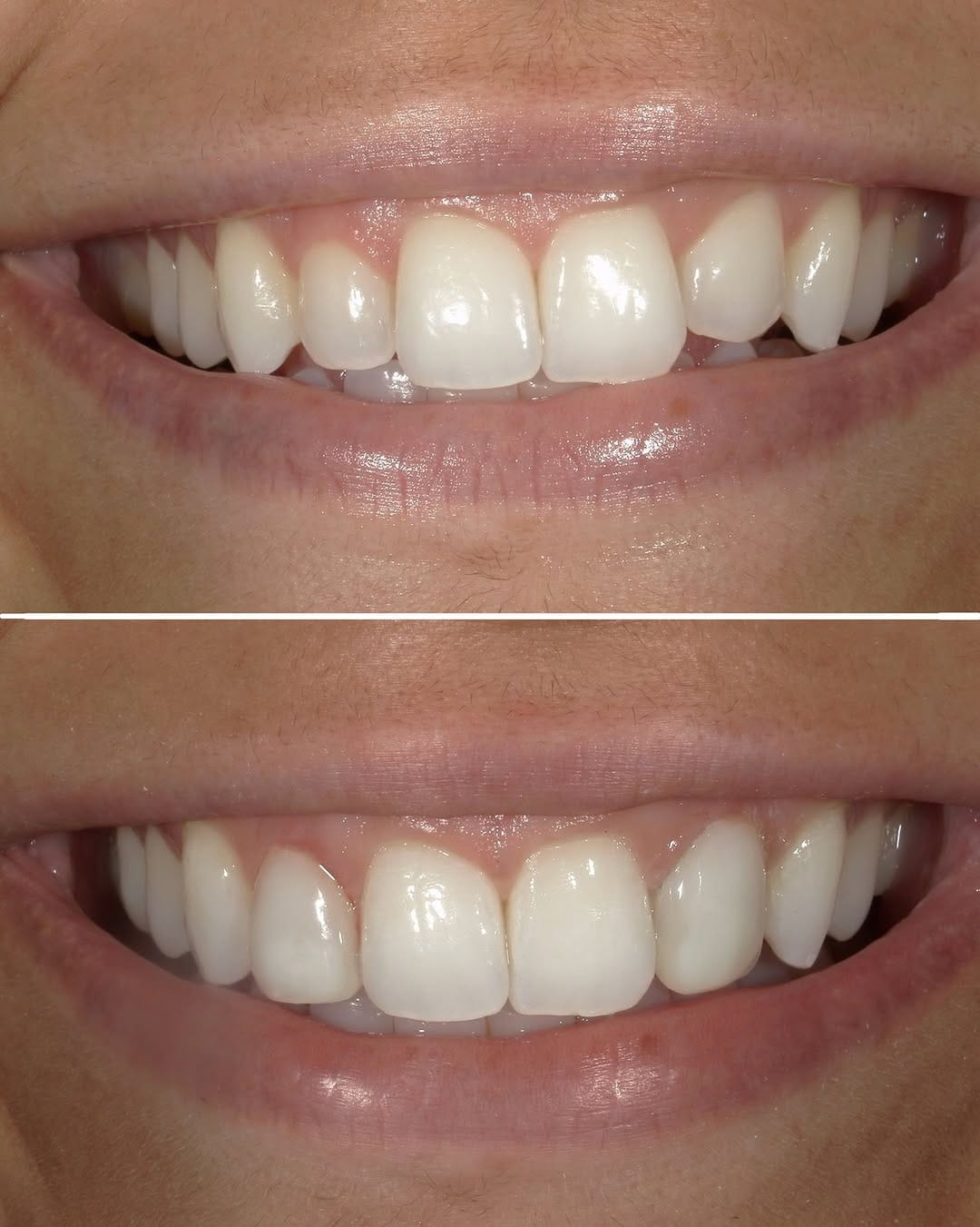 Post 8 by Dr. Domenica Paredes, DMD on Instagram (carousel)
