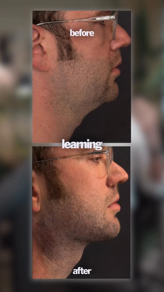 Post 7 by Simon Moradian, MD on Instagram (video)