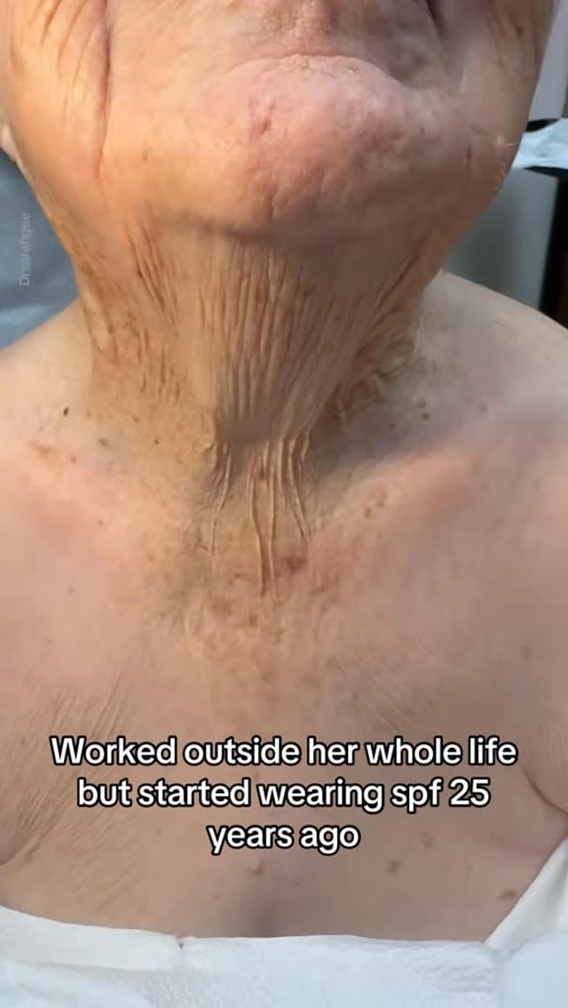 Post 3 by Sarah Gee MD FAAD on Instagram (video)