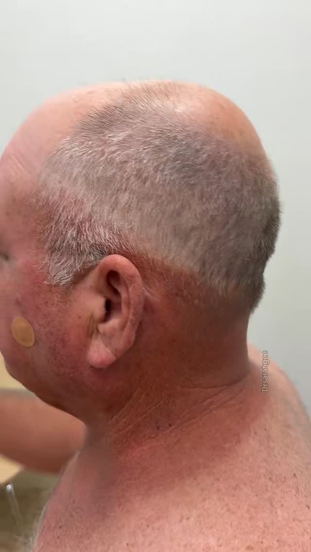 Post 6 by Sarah Gee MD FAAD on Instagram (video)
