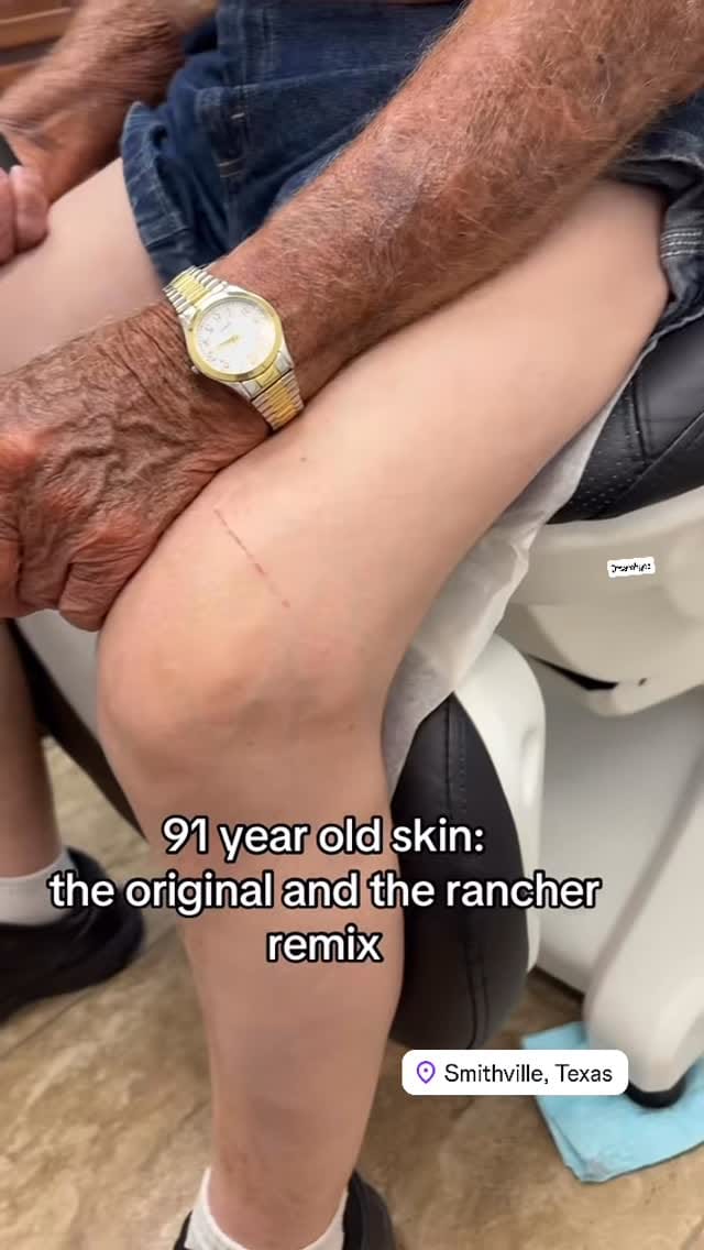 Post 8 by Sarah Gee MD FAAD on Instagram (video)