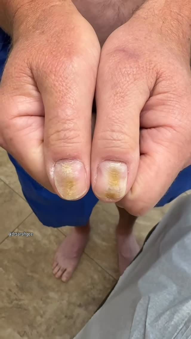 Post 4 by Sarah Gee MD FAAD on Instagram (video)