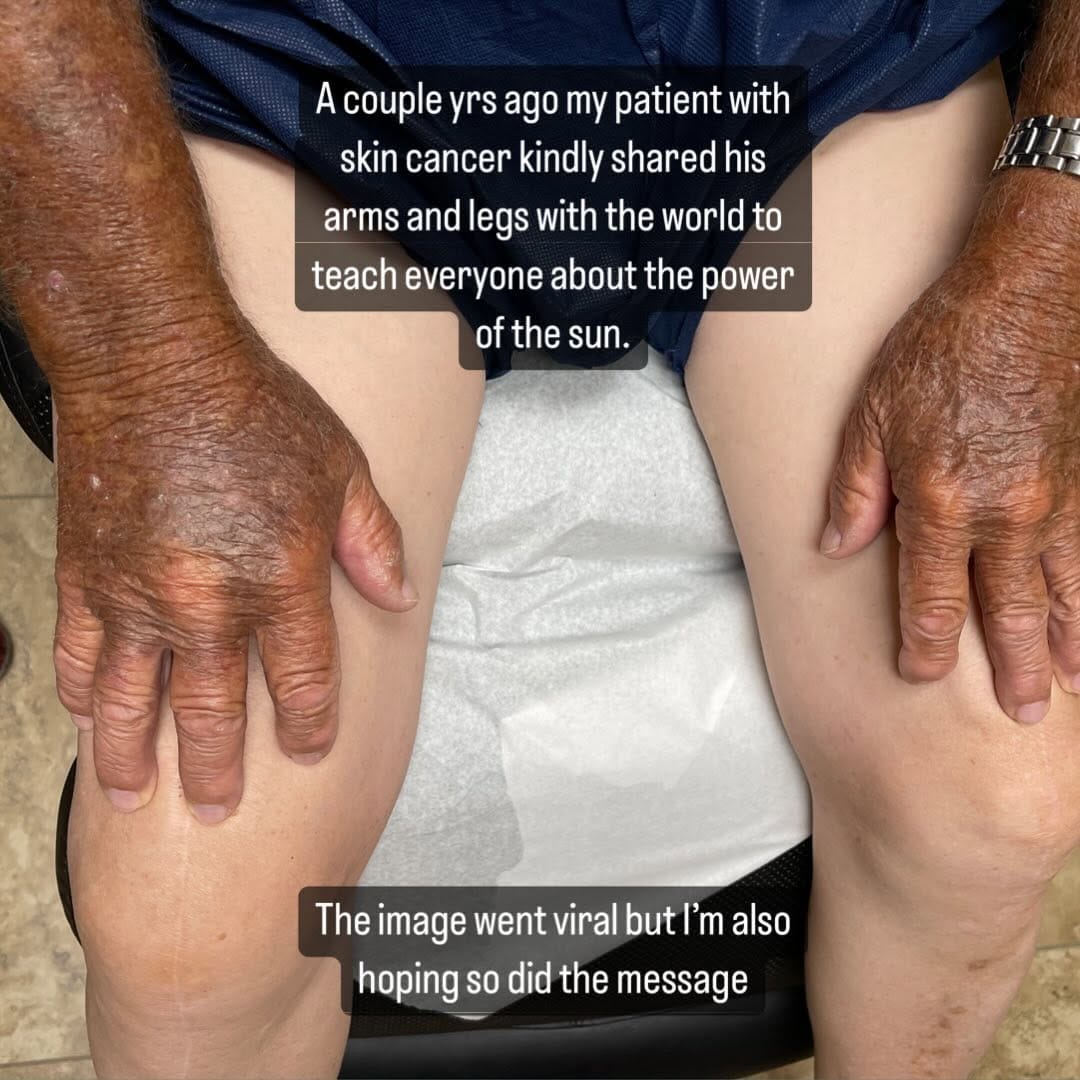 Post 10 by Sarah Gee MD FAAD on Instagram (image)