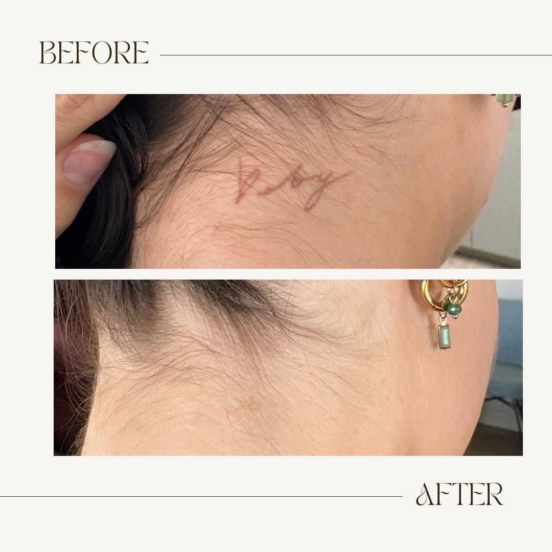 Post 4 by Timeless Skin & Wellness on Instagram (image)