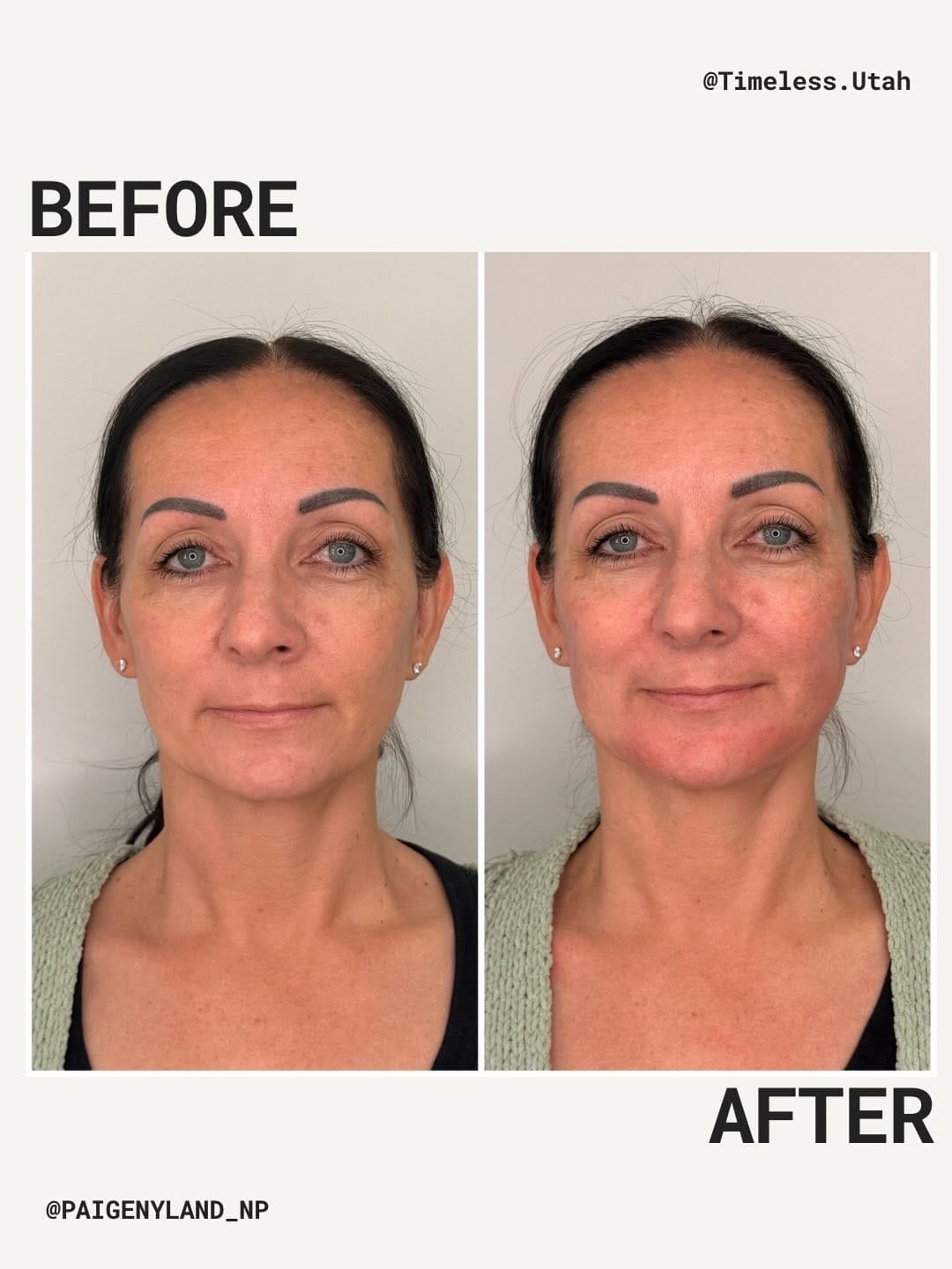 Post 9 by Timeless Skin & Wellness on Instagram (carousel)