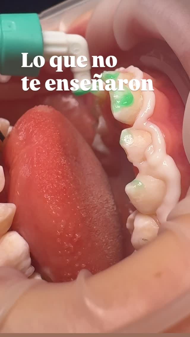 Post 6 by Dra Paloma Pérez. Odontopediatra en Valencia 🇪🇸 on Instagram (video)