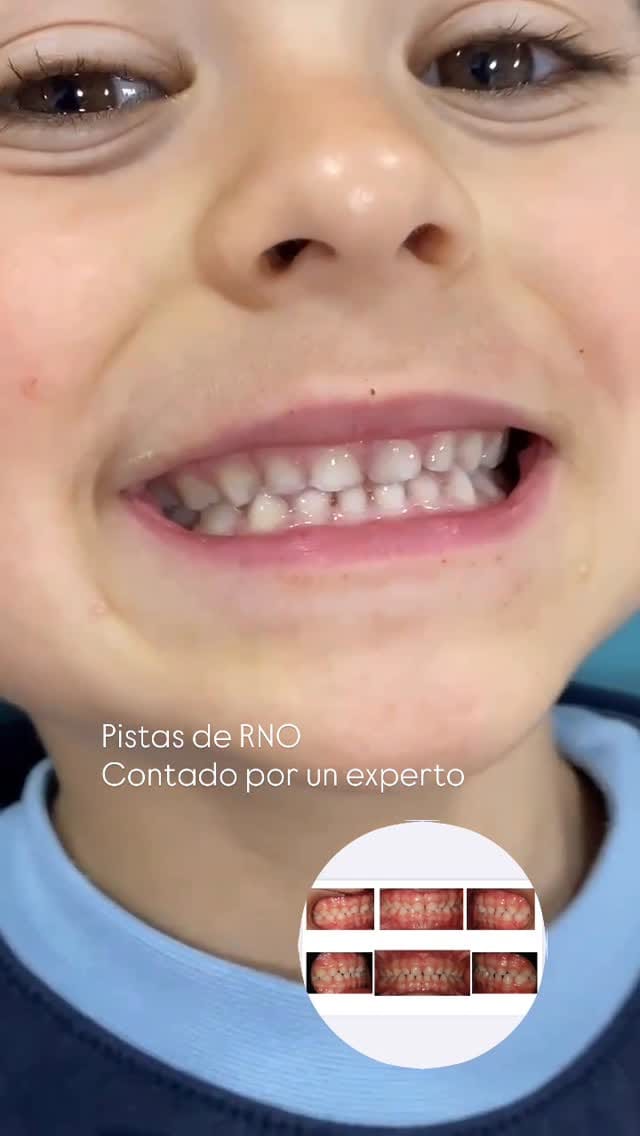 Post 4 by Dra Paloma Pérez. Odontopediatra en Valencia 🇪🇸 on Instagram (video)