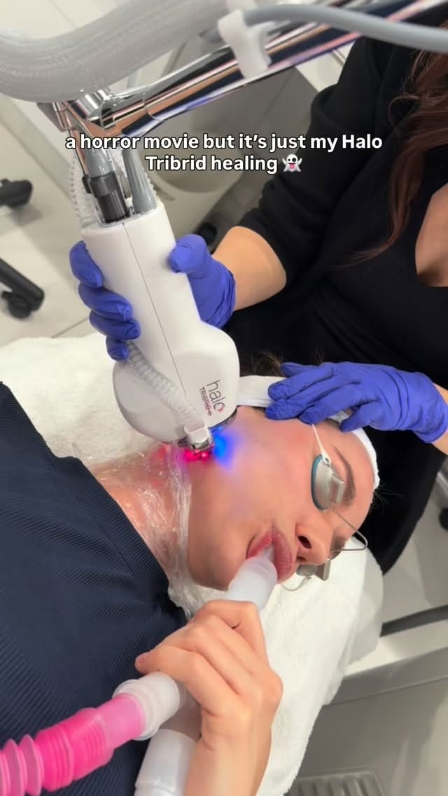 Post 7 by Kelowna’s Cosmetic Nurse Injector✨ on Instagram (video)