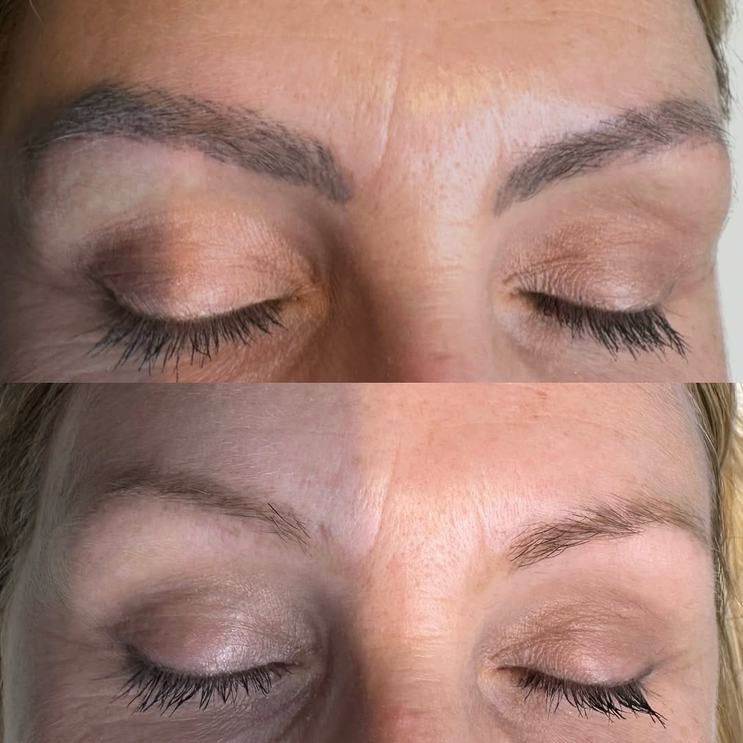 Post 2 by Samantha Thomas | PMU & Aesthetic Specialist - Kent on Instagram (carousel)