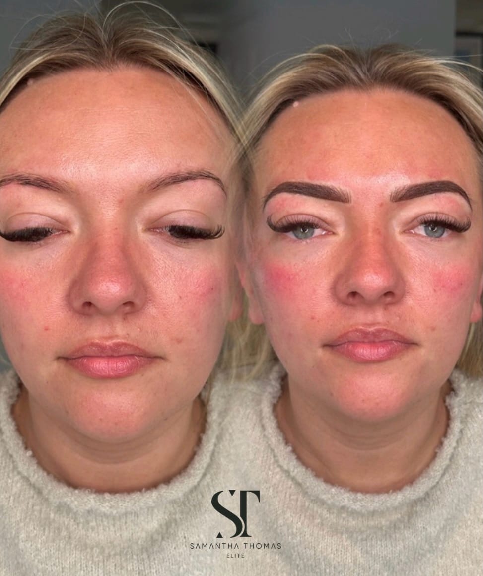 Post 5 by Samantha Thomas | PMU & Aesthetic Specialist - Kent on Instagram (carousel)