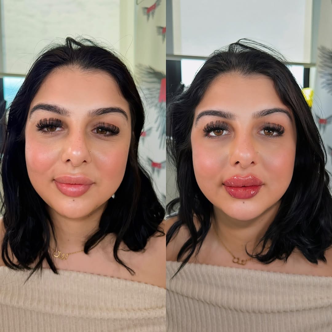 Post 7 by Angels Of The Valley Aesthetics Clinic&Training Academy on Instagram (image)