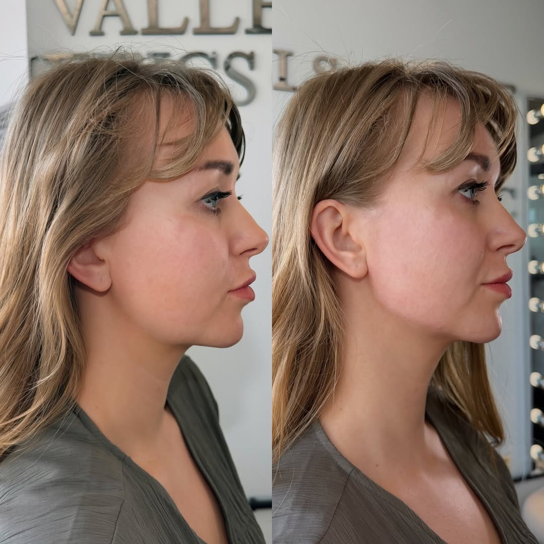 Post 4 by Angels Of The Valley Aesthetics Clinic&Training Academy on Instagram (image)