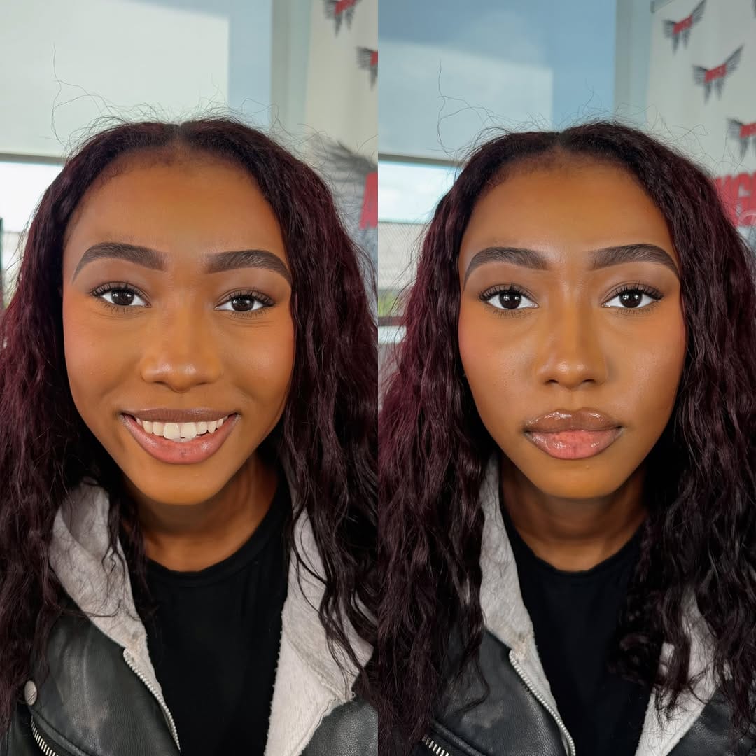 Post 5 by Angels Of The Valley Aesthetics Clinic&Training Academy on Instagram (image)