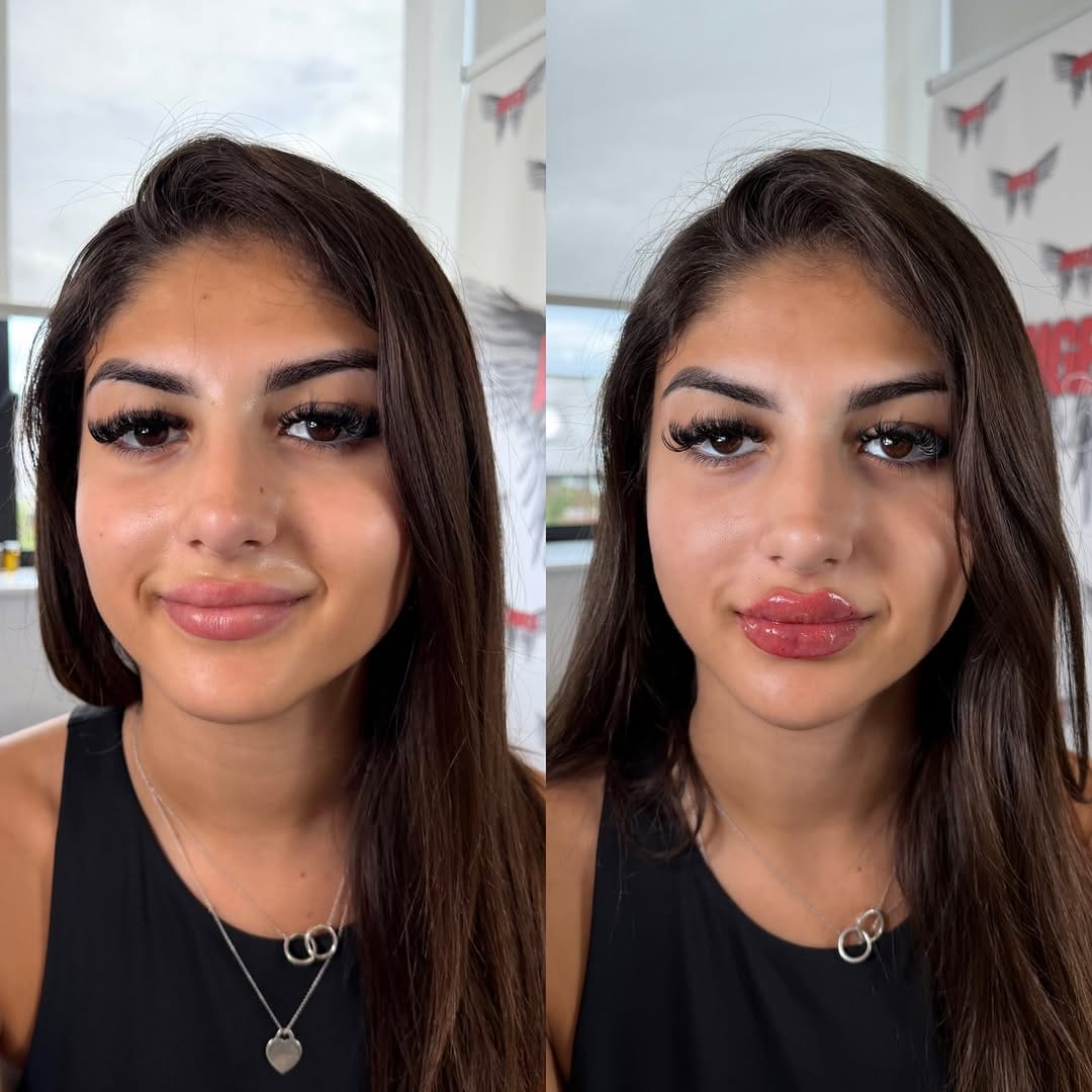 Post 6 by Angels Of The Valley Aesthetics Clinic&Training Academy on Instagram (image)