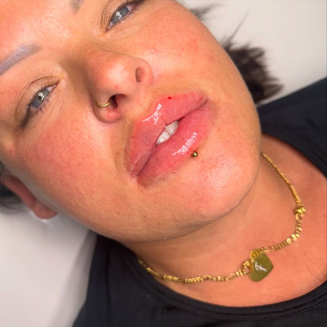 Post 2 by Lauren Mac Aesthetics on Instagram (image)