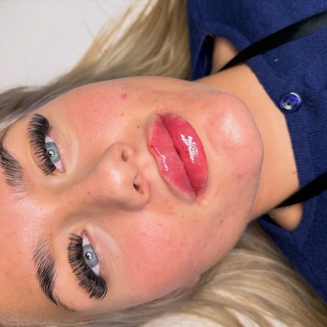 Post 4 by Lauren Mac Aesthetics on Instagram (image)