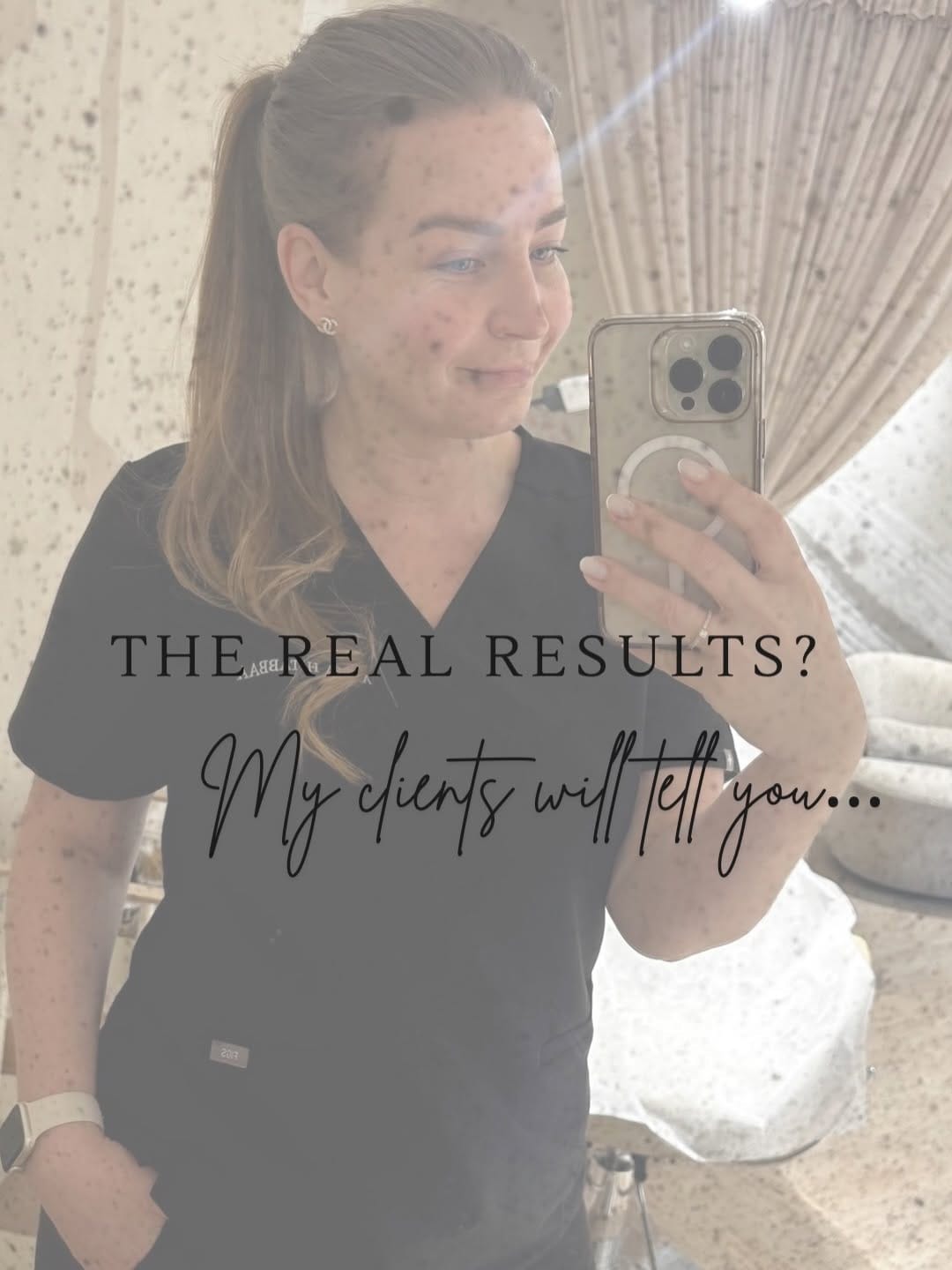 Post 6 by DHA Licensed Esthetician | Dubai London | Microneedling | Facial on Instagram (carousel)