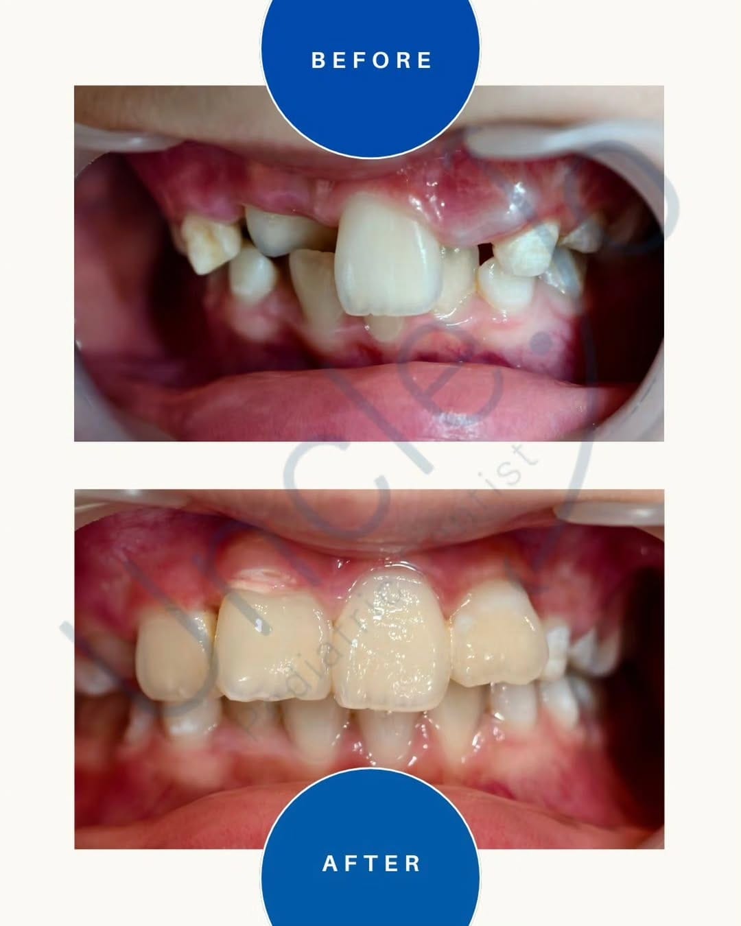 Post 9 by drg. Joshua Calvin, Sp.KGA| Airway Pediatric Dentist| Uncle Jo on Instagram (carousel)
