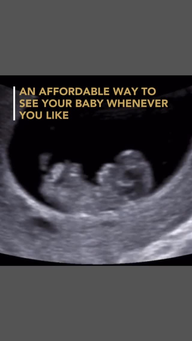 Post 6 by Hello Baby 3D®️ on Instagram (video)