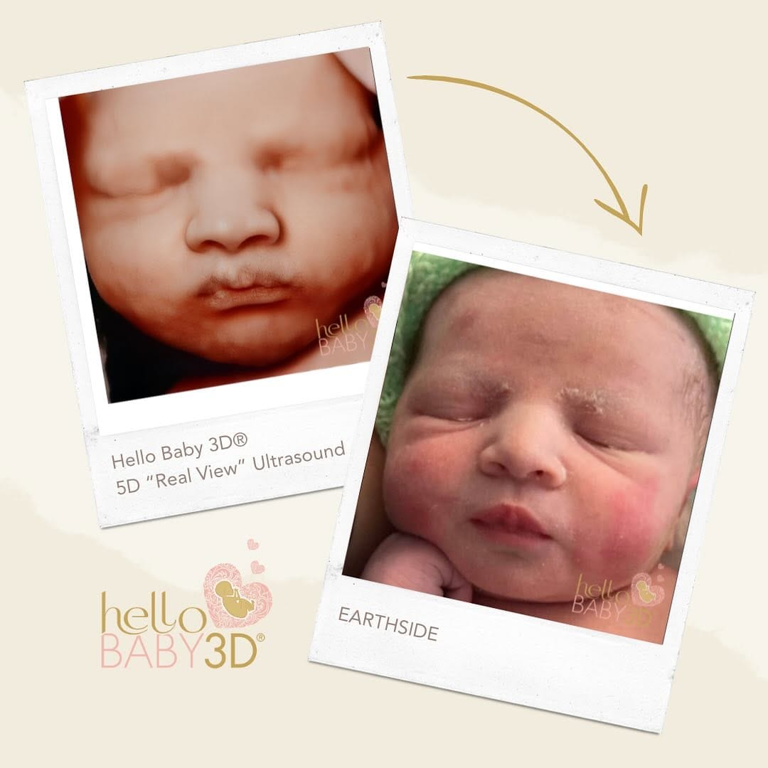 Post 9 by Hello Baby 3D®️ on Instagram (image)