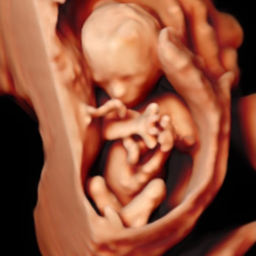 Post 7 by Hello Baby 3D®️ on Instagram (image)