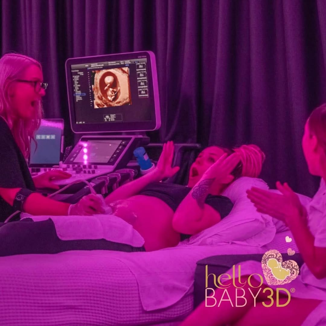 Post 10 by Hello Baby 3D®️ on Instagram (image)