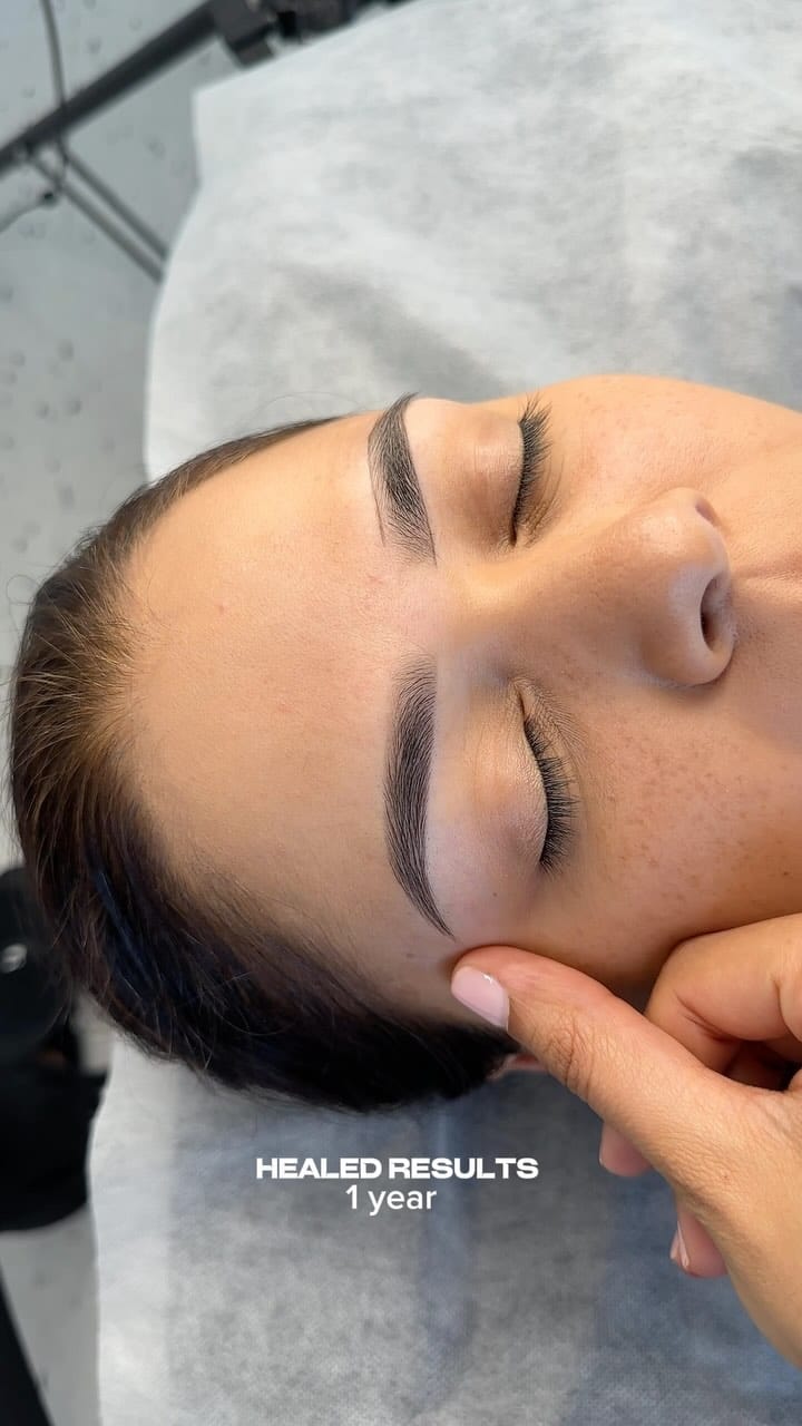 Post 8 by Kim♡ | Brows Lips & Scar Specialist on Instagram (video)