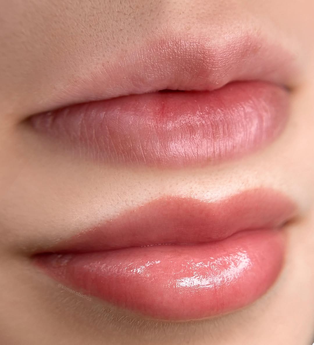Post 1 by Kim♡ | Brows Lips & Scar Specialist on Instagram (carousel)