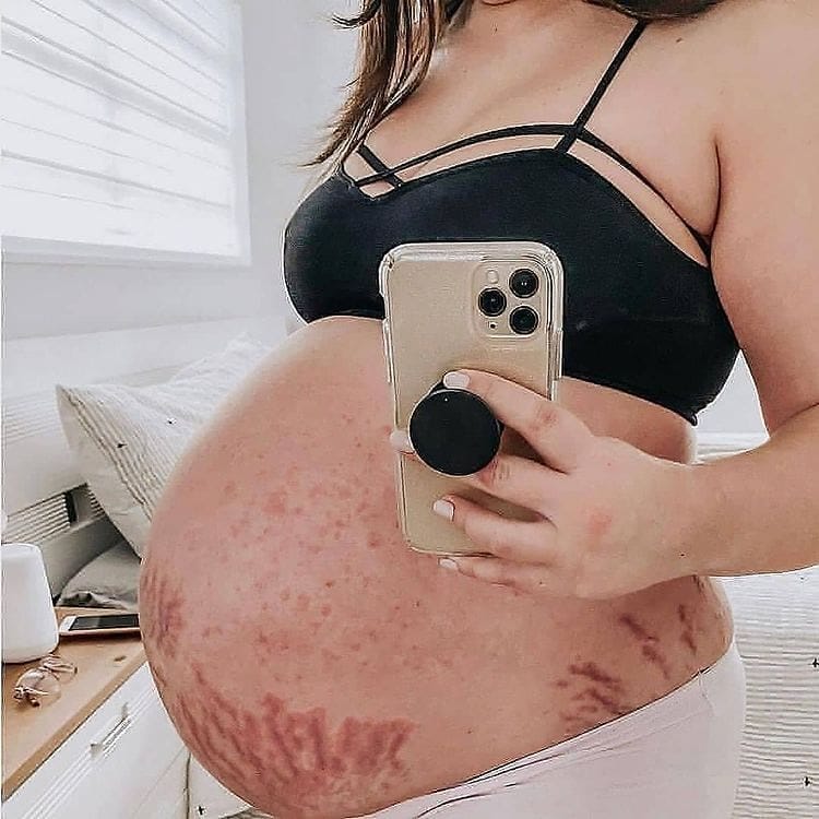 Post 10 by #PREGNANCY & DIET SOLUTION on Instagram (image)